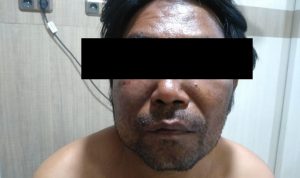 Wartawan Media Online Jadi Korban Penculikan dan Penganiayaan di Labuhan Belawan (V24/AL)