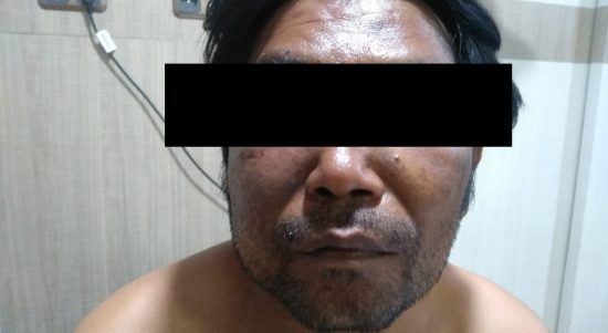 Wartawan Media Online Jadi Korban Penculikan dan Penganiayaan di Labuhan Belawan (V24/AL)